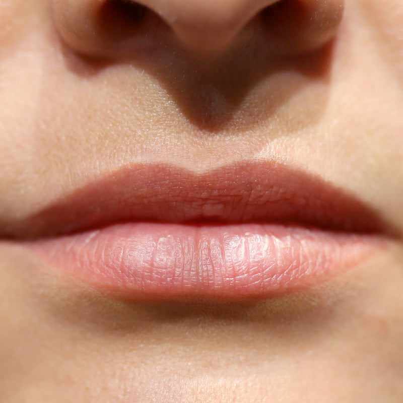 Functionalab Collagen Lip Infusion: before photograph supplied by Functionalab