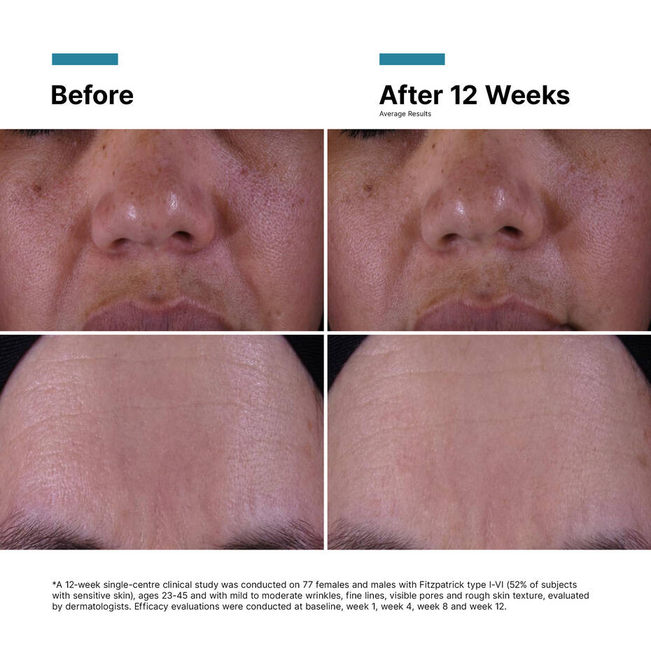 SkinCeuticals P-TIOX Cream Before and After