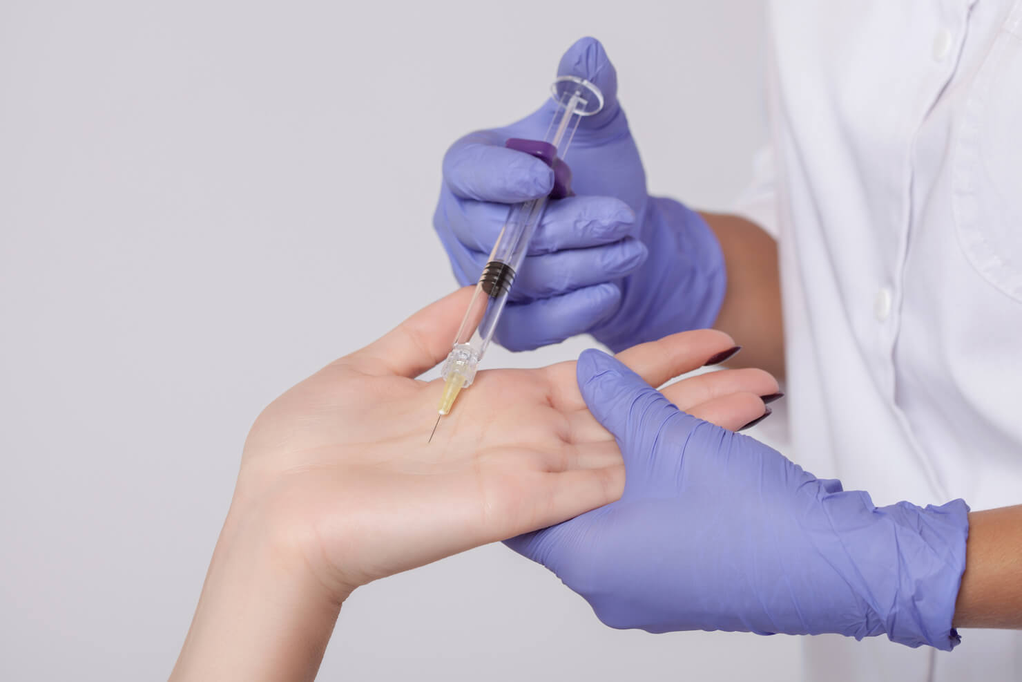 Palmar hyperhidrosis Botox injection to stop sweaty clammy hands temporarily