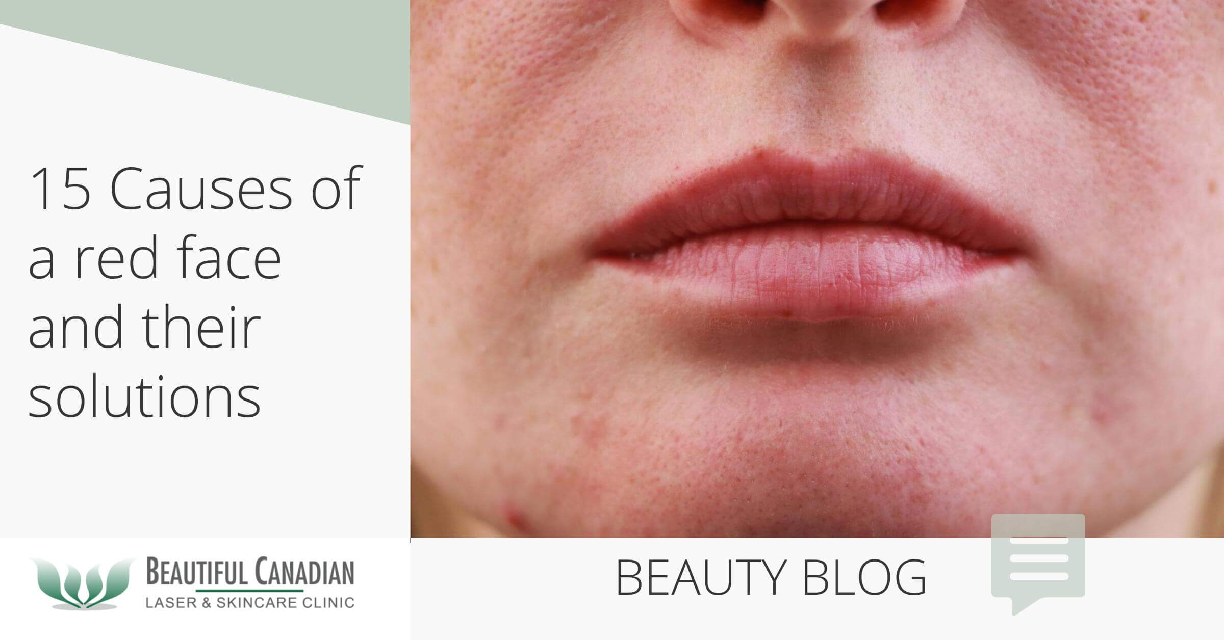 15 Causes Of A Red Face & Their Solutions Skin Care Centre Surrey