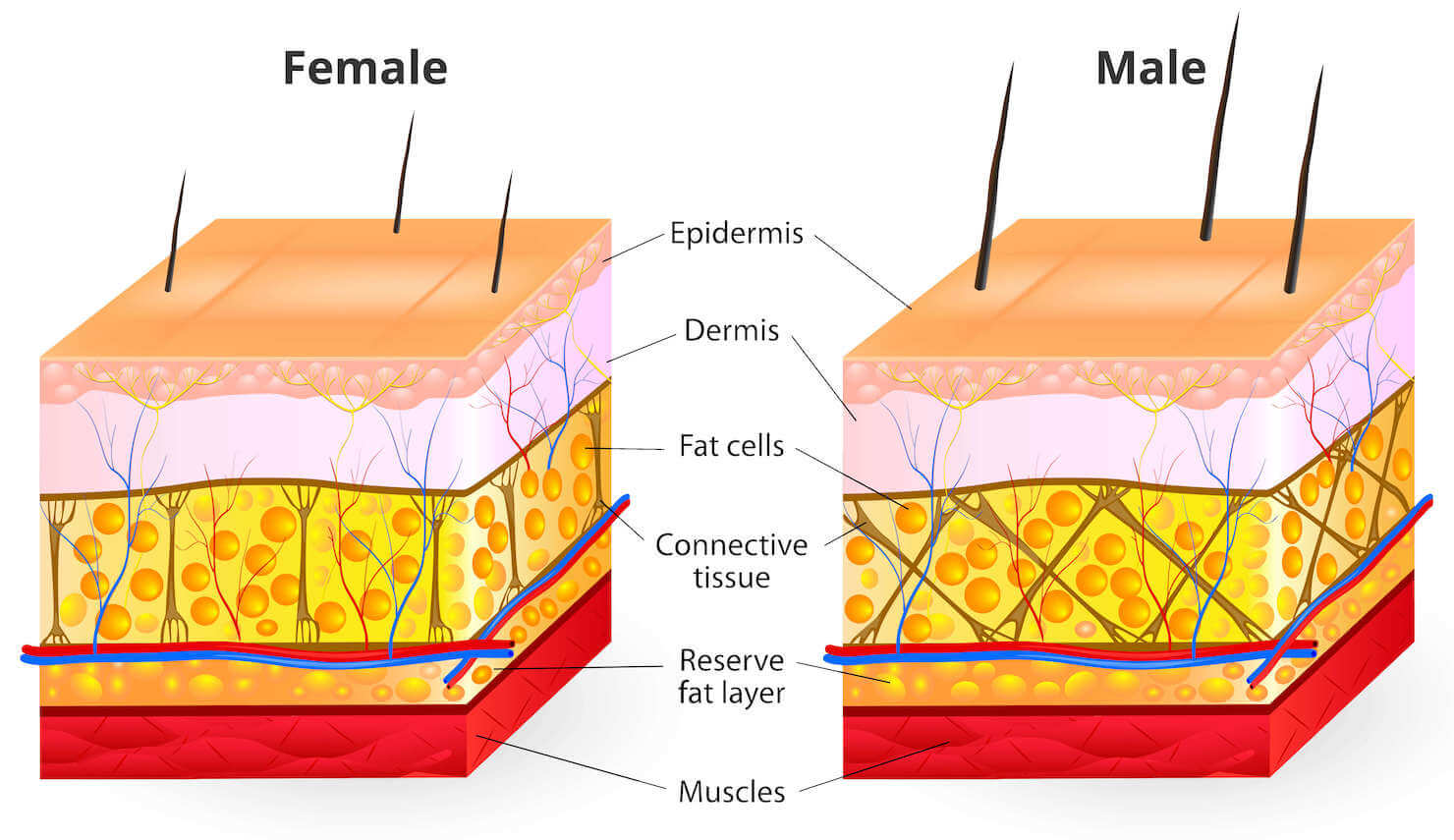 cellulite fat cells formation diagram - female and male