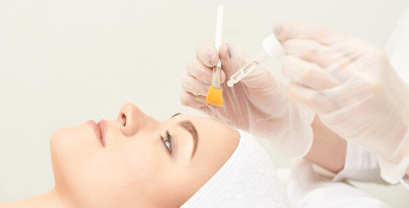 chemical peels treatment session