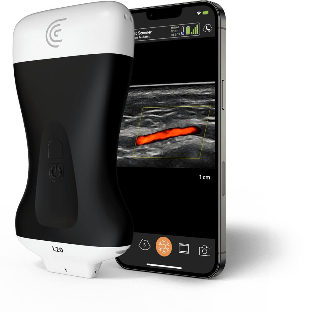 Ultrasound Dermal Filler Treatments & Corrections Vancouver, Surrey