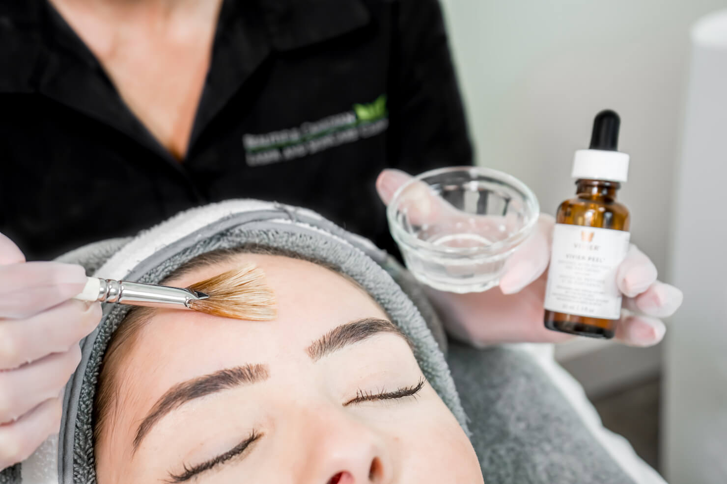 close up chemical peel brush on liquid - Surrey skin treatment