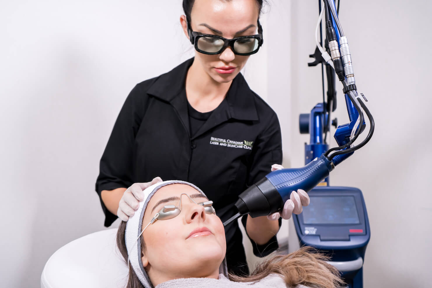 CO2 laser skin resurfacing in surrey clinic