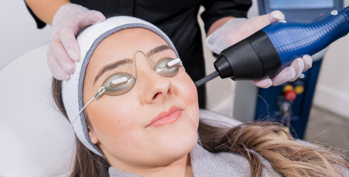 CO2 skin resurfacing rejuvenation treatment in surrey on face