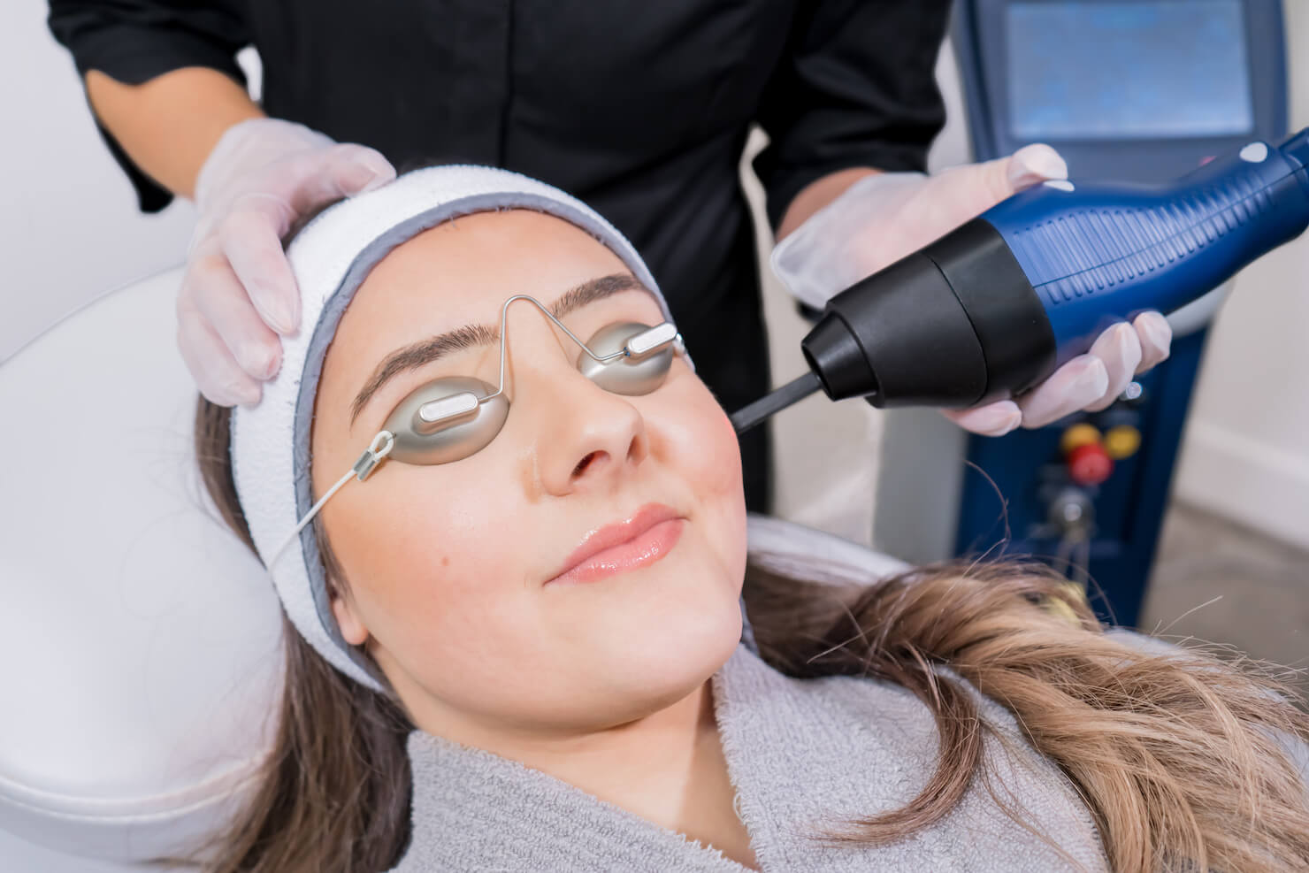 CO2 skin resurfacing treatment in surrey on face