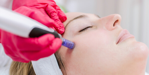 dermapen facial treatment session on woman