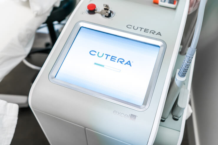 excel V laser by cutera machine screen starting up for laser clinic treatment in surrey