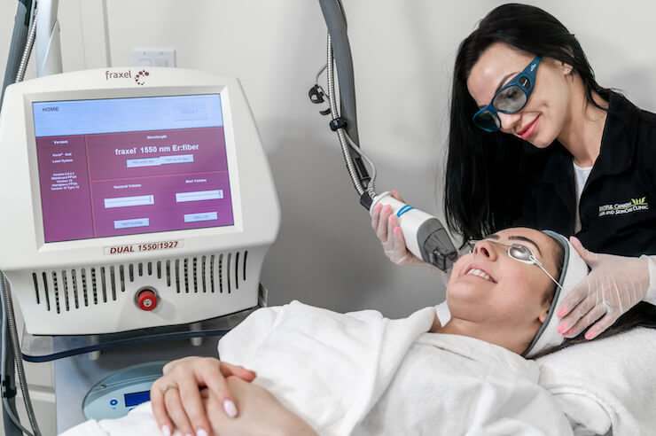 fraxel dual skin resurfacing treatment performed in surrey bc at bc laser and skincare clinic