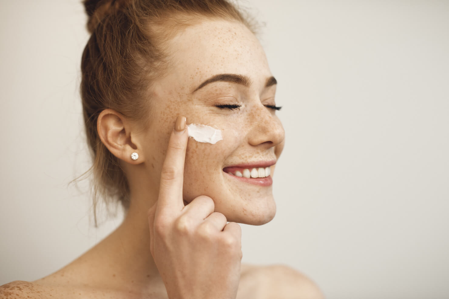 Freckled woman with sun damage pigmentation using skin care cream on face