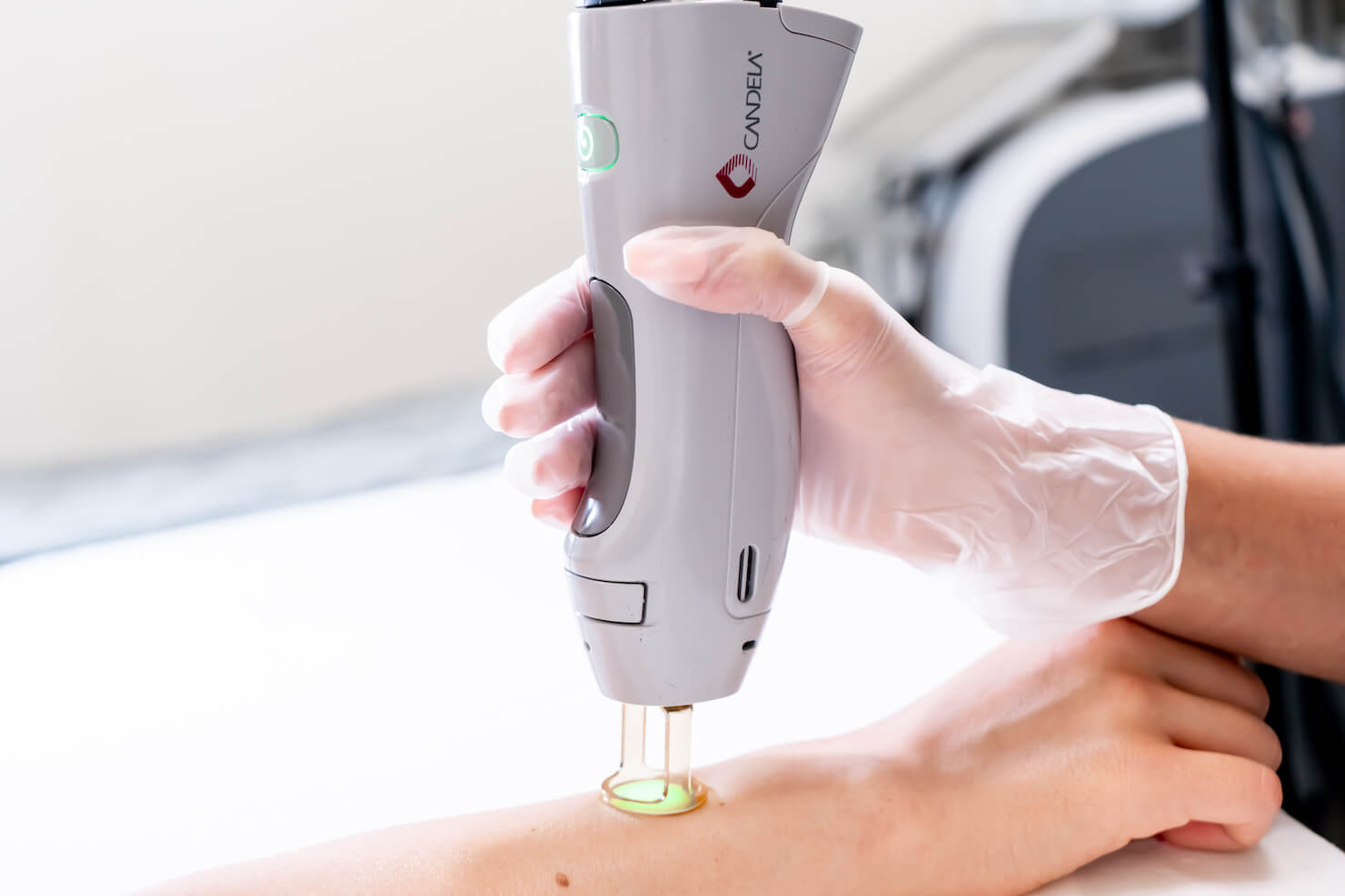 Clearfield Laser Hair Removal 