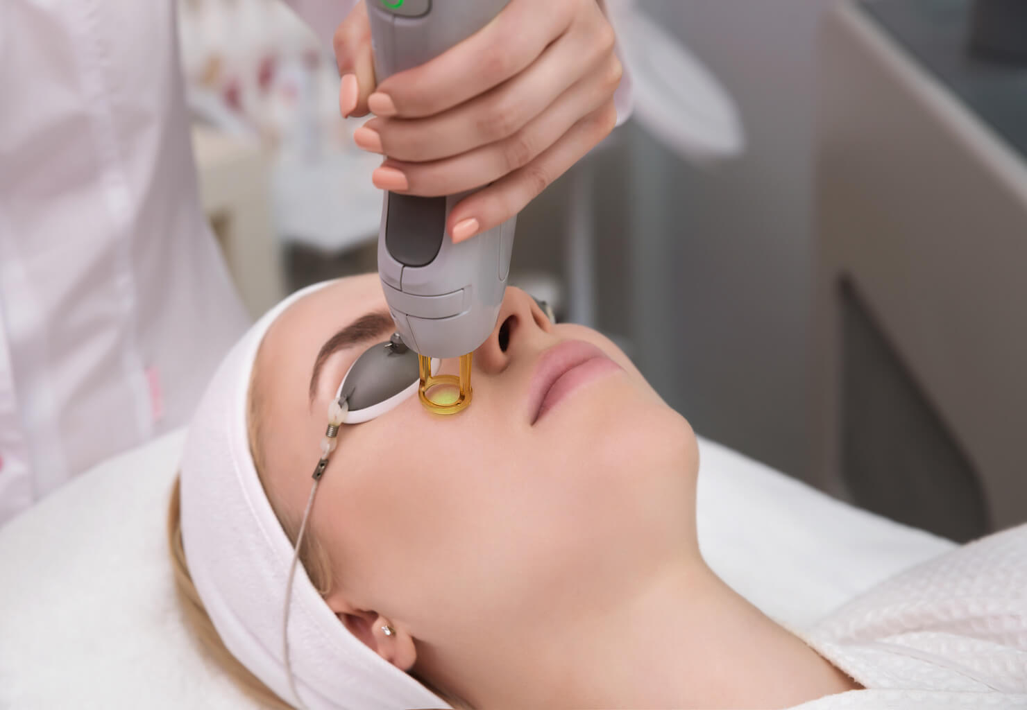 Photofacial on a woman's face for sun damage or pigmentation and skin rejuvenation