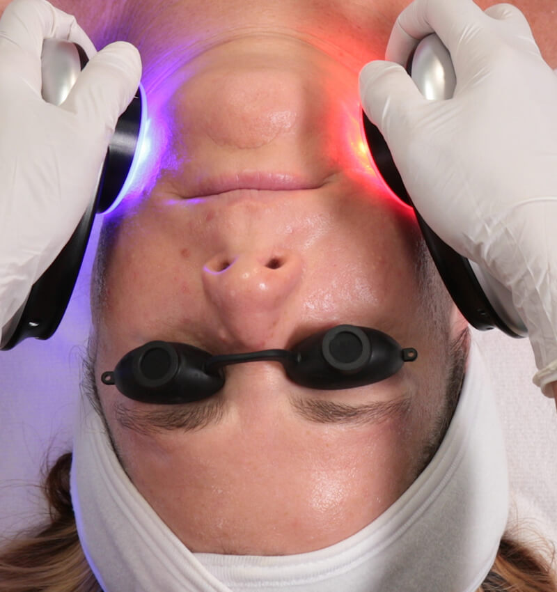 Blue and red led light therapy for skin healing and anti-aging or acne treatments with HydraFacial