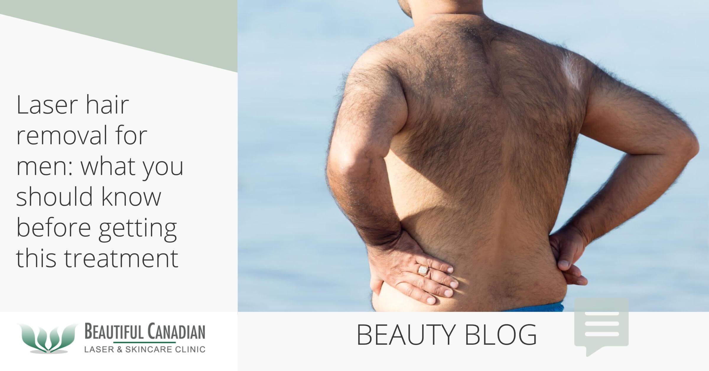 Laser Hair Removal For Men: What You Should Know Before Getting This Treatment Laser Hair Removal For Men: What You Should Know Before Getting This Treatment