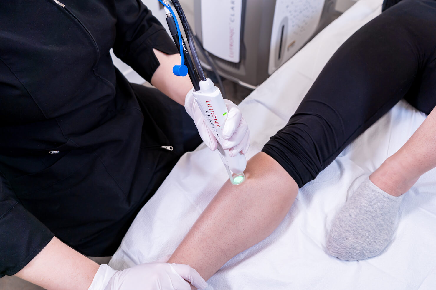 Before and After Care: Get the Best Results from Laser Hair Removal Before and After Care: Get the Best Results from Laser Hair Removal