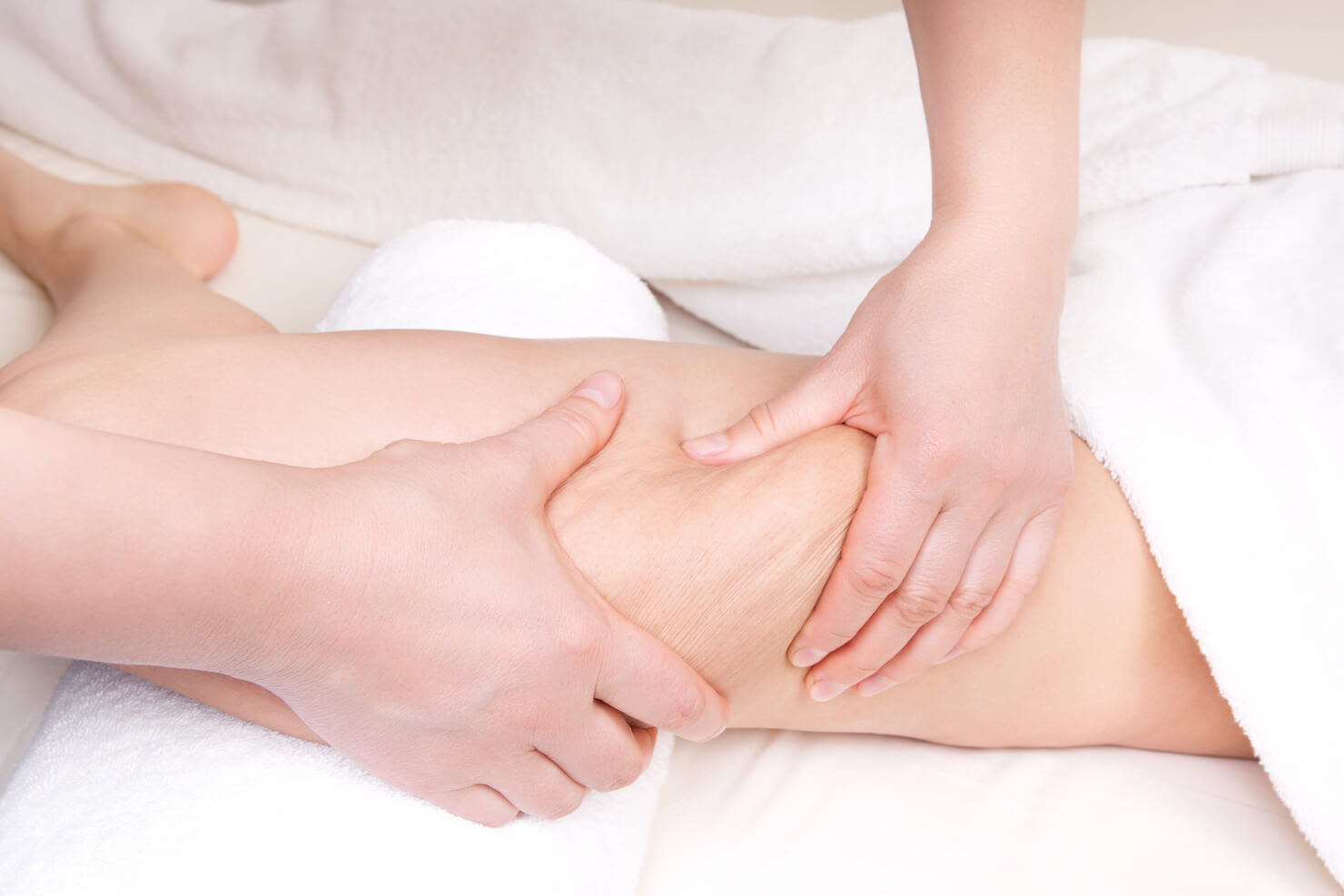 Mild cellulite visible when squeezing - at a spa for cellulite treatment