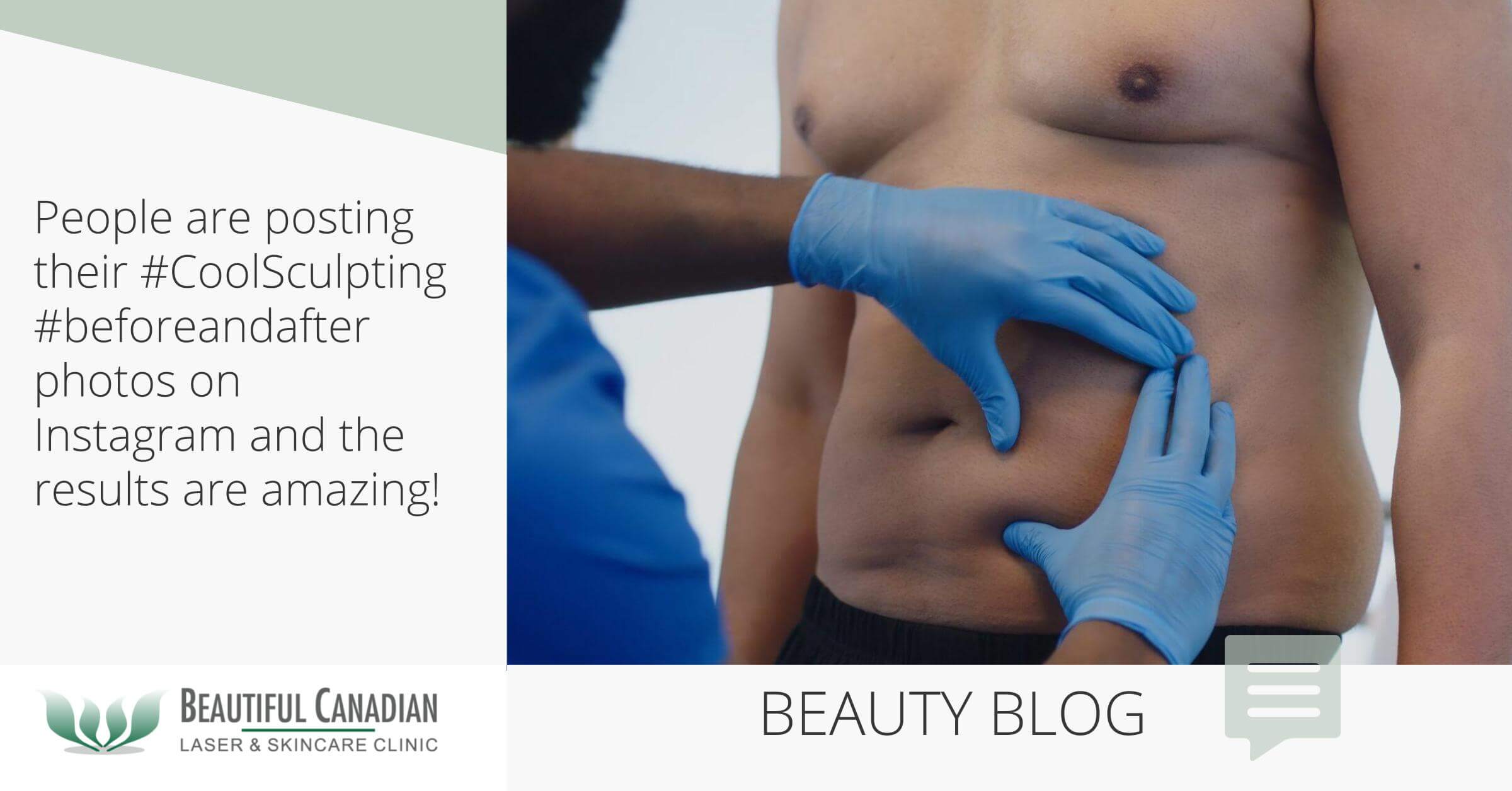 People Posting Instagram CoolSculpting 'Before & After' Photos (The Results  Are Amazing!)