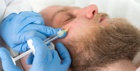 sculptura facial filler treatment to increase volume being injected into patient