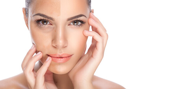 skin pigmentation half screen of woman with two colour skin tones
