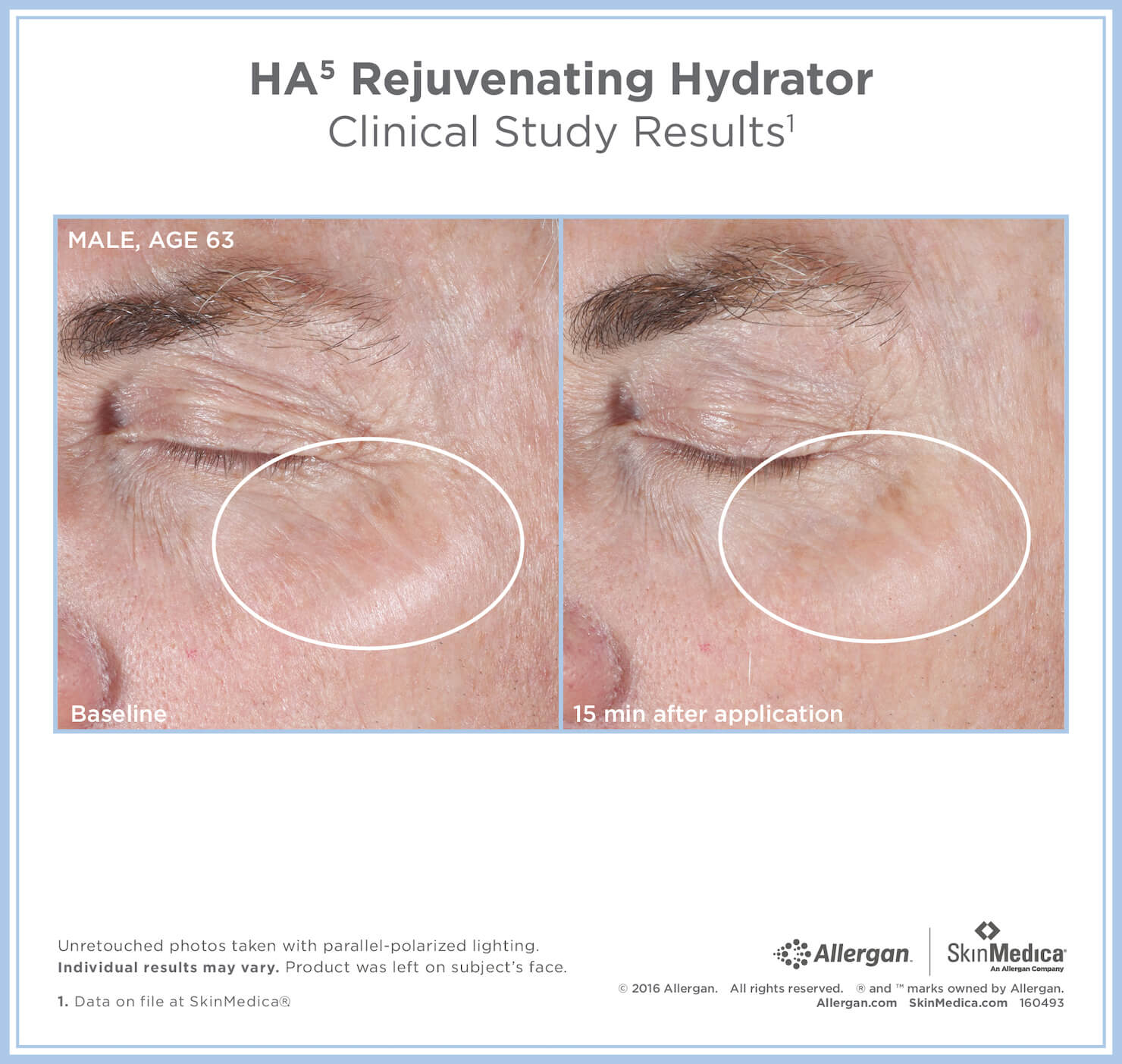 HA5™ Rejuvenating Hydrator by SkinMedica® Hyaluronic Acid Serum Buy Online Canada