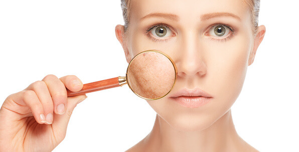 woman with sun damage on skin on cheek with magnifying glass