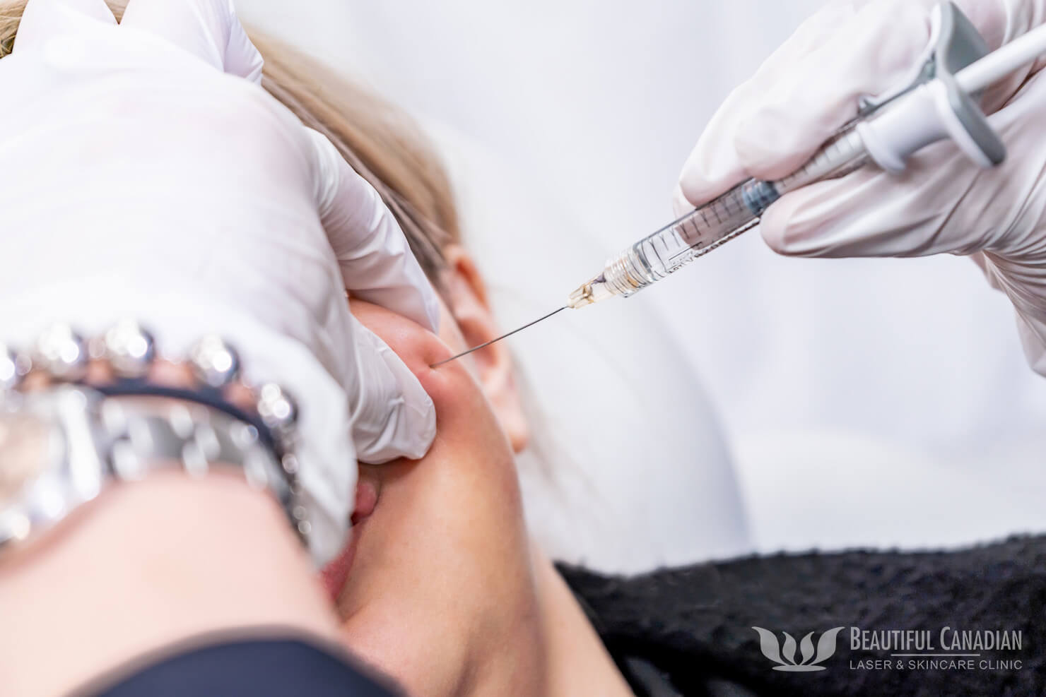 Needle Guide: Excelling in Medical Procedures