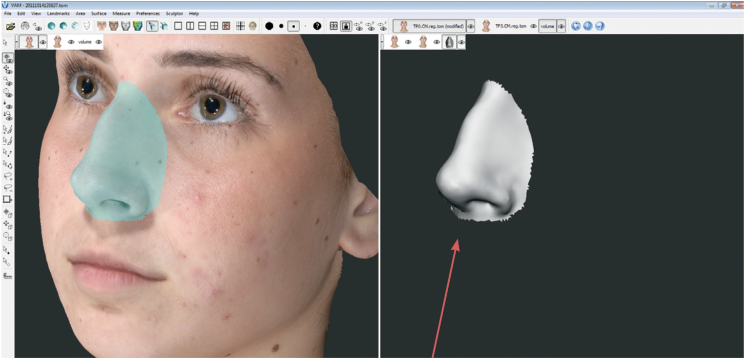 Vectra 3D grey mode nose shape selector visualization
