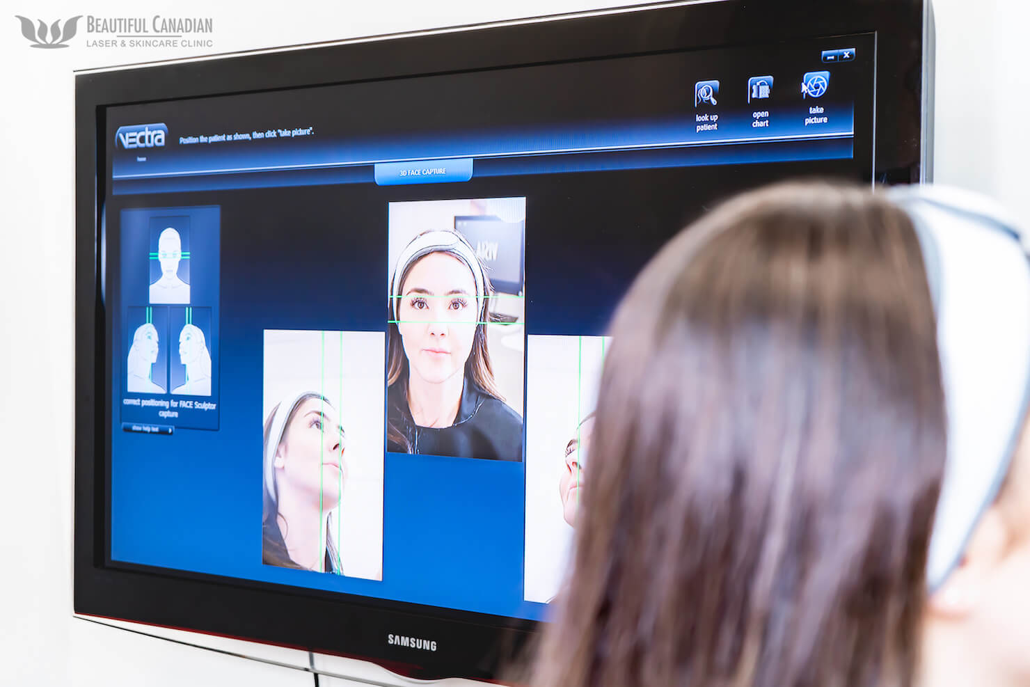 Vectra 3D Imaging System showing three photos that it will stitch together for a complete 3D model before skin and beauty treatments