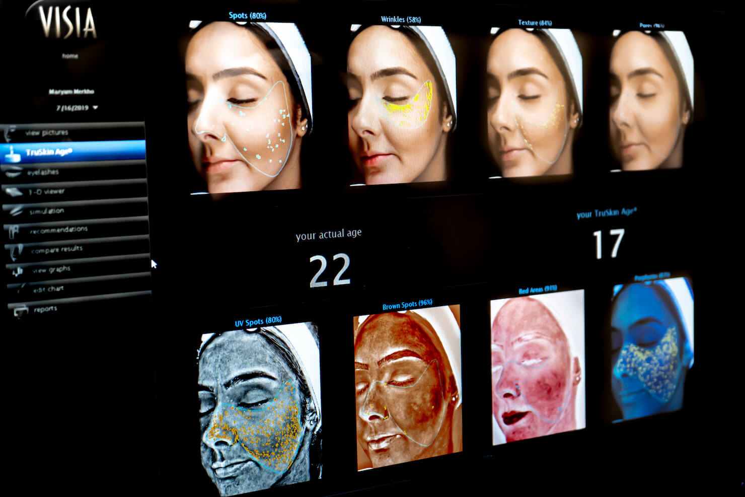 visia skin analysis true age skin scan technology showing different computerized face views